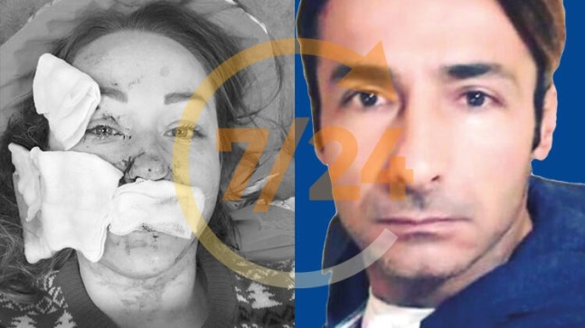 O cani hâlâ tehdit ediyor