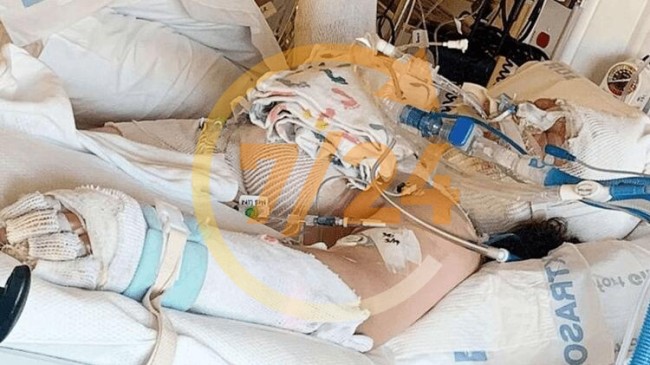 TikTok ‘challenge’ı 13 yaşındaki çocuğu hastanelik etti