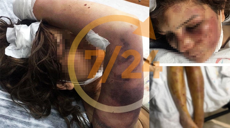 Şanlıurfa'da kan donduran olay! Günlerce akılalmaz işkenceler yaptı